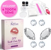 SelfGem® DIY Tooth Gem Kit | Butterfly Set | Incl. 6 Tooth Gems | Gebruiksvriendelijk | Hoogwaardig Swarovski | Tand Diamantje Kit | Tand Kristal | Tooth Gems Diamanten