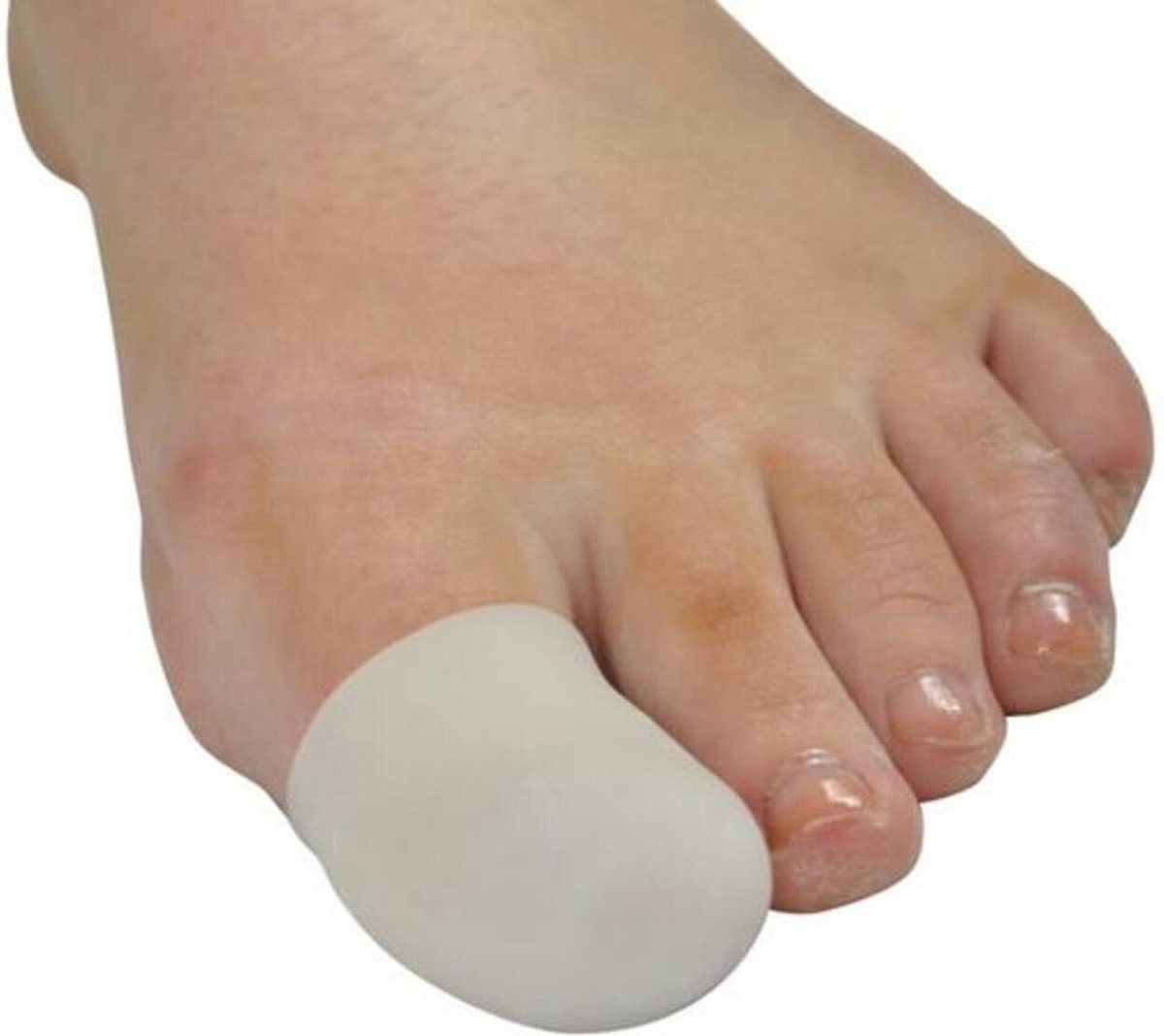 Goedkoopste CHPN - Teenspreider - Teenbeschermer - Teenpijn - Pijnlijke teen - Teen correctie - 2stuks - Siliconen - Gespreide tenen - One size