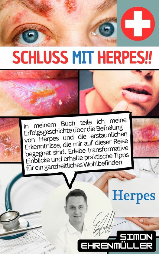 Schluss mit Herpes (ebook), Simon Ehrenmüller 9783757987879 Boeken bol
