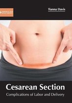 Cesarean Section