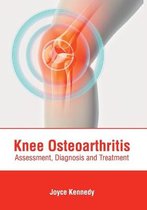 Knee Osteoarthritis