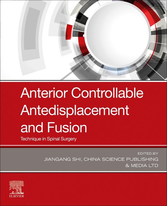 Anterior Controllable Antedisplacement and Fusion (ACAF) - cover