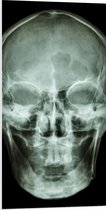 PVC Schuimplaat- Röntgenfoto van Mensenschedel - 50x100 cm Foto op PVC Schuimplaat