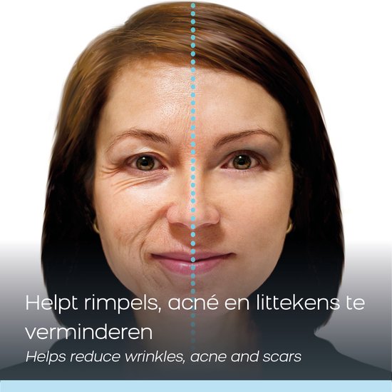 Celltone Dagcrème Slakkenslijmcrème - 50 ML - Anti rimpel - Littekencrème - Slakkencrème voor acne puistjes rimpels - Acneverzorging - Slakken Extract serum gel voor vrouwen mannen tieners - escargot cream voor gezicht en onder de ogen - Snailcare