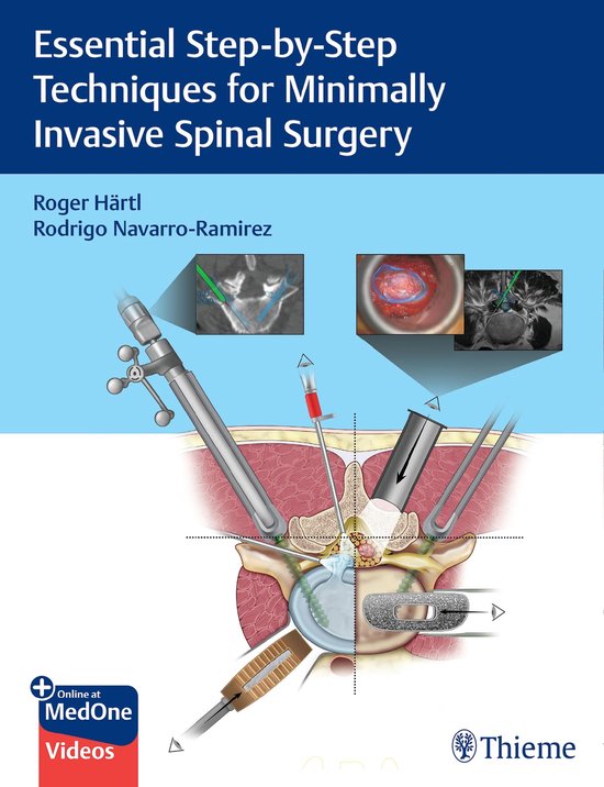 Essential Step-by-Step Techniques for Minimally Invasive Spi ... - cover