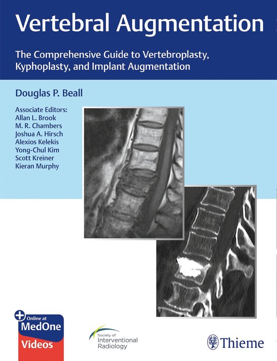 Vertebral Augmentation - cover
