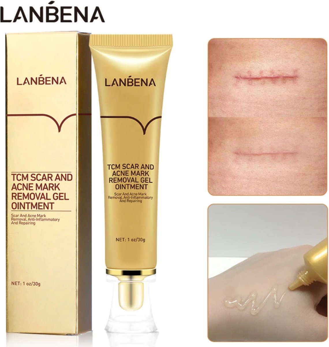 LANBENA Littekencrème - Vermindert zichtbaarheid van littekens – Acné en Striae littekens - Herstelt de huid - Litteken crème tube 30ml