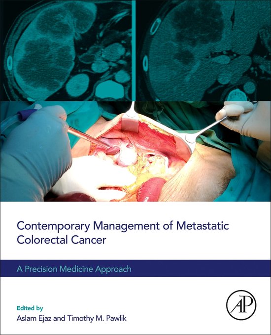 Contemporary Management of Metastatic Colorectal Cancer - cover