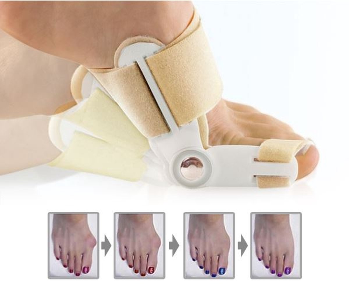 Goedkoopste Teencorrector - Hallux Valgus - MeditorPlus