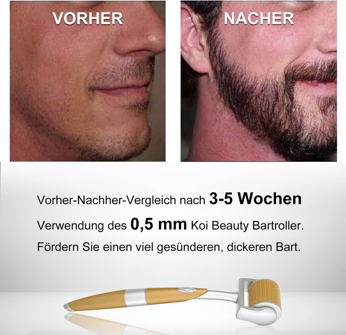 Goedkoopste Gezichtsmassage apparaat – Huidverjongingsapparaat - Massagehulpmiddel – Gezichtsmassage – Massage