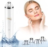 Lofrader Black Head Remover – Poriënreiniger – Vacuüm - Gezichtsreinigingsborstel met 4 Opzetstukken
