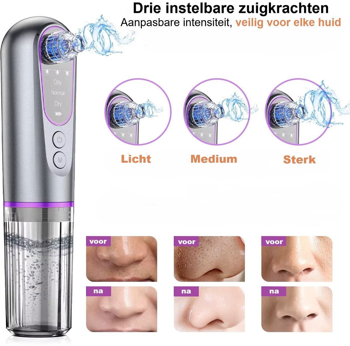 Y!skah Hydro-Facial: Vacuüm-poriënreiniger met 3 zuigstanden en 5 opzetstukken thumbnail 2
