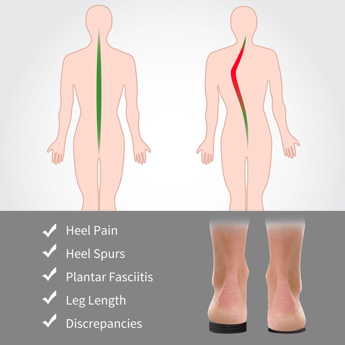 Dailygoods - Dailygoody - Verstelbare inzetstukken - Hielverhogingen - Orthopedisch comfort - Kleur zoals afgebeeld - Inlegzolen voor extra hoogte - Geschikt voor .