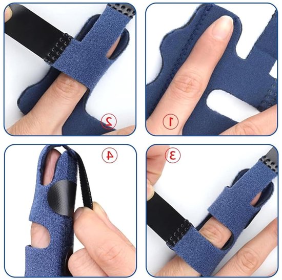 Set van 2 Verstelbare Vinger Splints voor Breuk en Trigger Finger, Wasbare Ondersteuning voor Artritis en Vingerblessures — afbeelding 3
