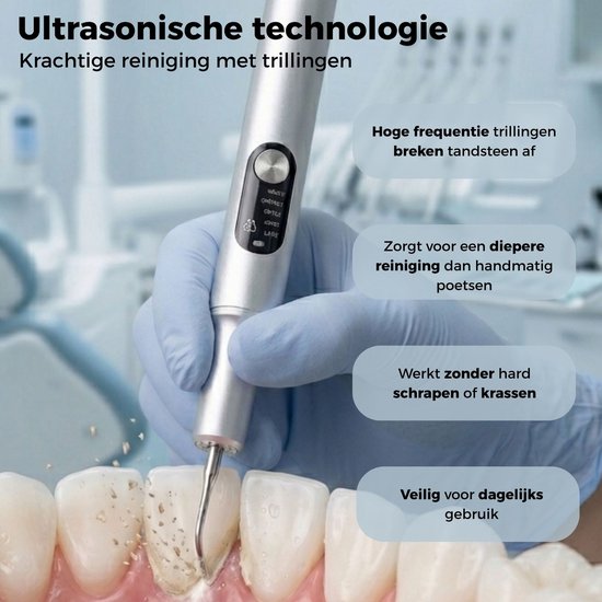 Close-up van ultrasonische tandsteenverwijderaar die tandsteen op tanden verwijdert. De hand is in een blauwe handschoen.