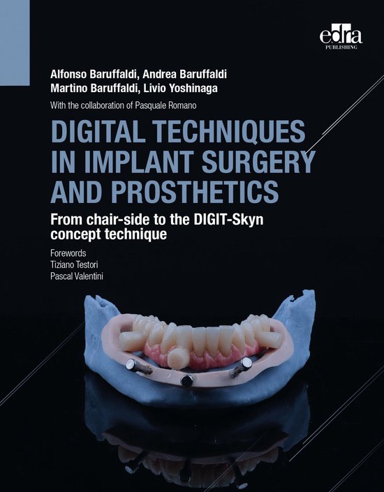 Digital Techniques in Implant Surgery and Prosthetics (ebook), Andrea ...