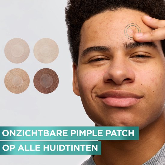 Jongeman met Garnier puistjespleisters op de huid, in vier tinten.