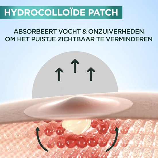 Illustratie van een Garnier hydrocolloïd pleister die vocht absorbeert.