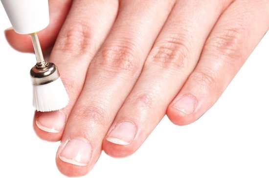 Bol Com Promed Opzetstukjes Set Nagelfrees Comfort 17 Delig Opzetstukjes Voor Huid Likdoorn