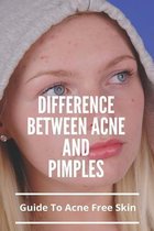 Difference Between Acne And Pimples: Guide To Acne Free Skin