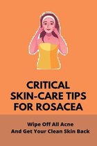 Critical Skin-Care Tips For Rosacea: Wipe Off All Acne And Get Your Clean Skin Back