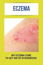 Eczema: My Eczema Cure To Get Rid Of Dyshidrosis