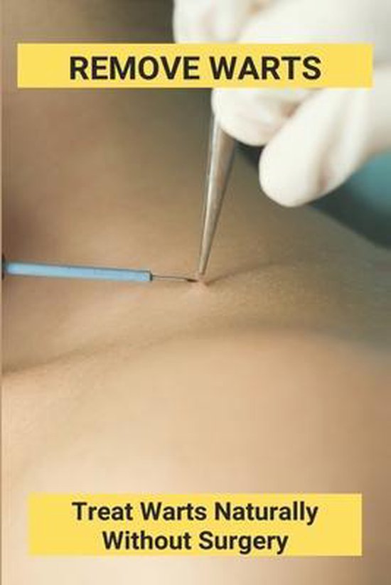 Remove Warts - cover