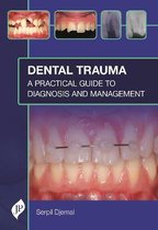 Dental Trauma