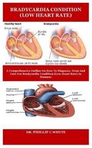 Bradycardia Condition (Low Heart Rate)