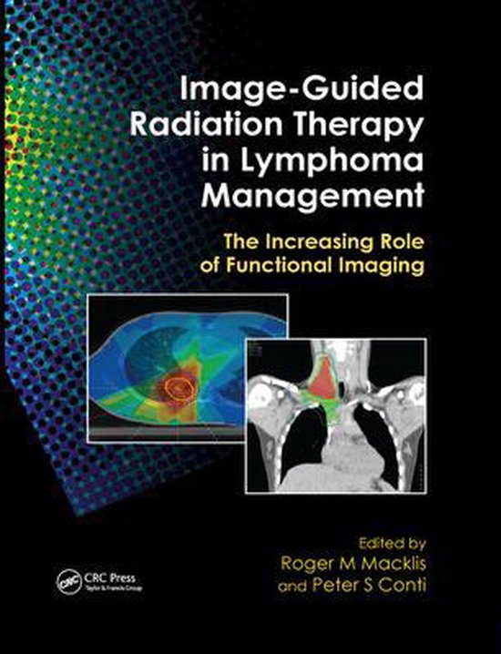 ImageGuided Radiation Therapy in Lymphoma Management 9780367384487