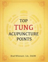 Top Tung Acupuncture Points