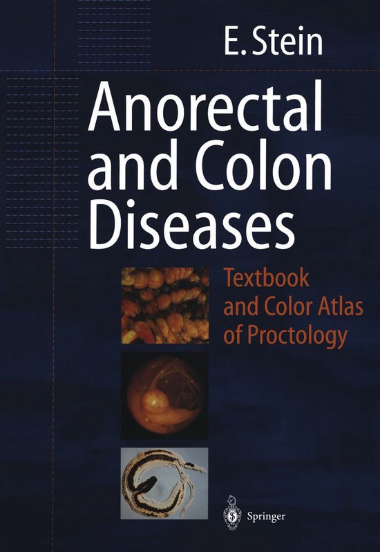 Medicine (R0) - Anorectal and Colon Diseases - cover