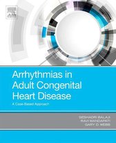 Arrhythmias in Adult Congenital Heart Disease