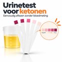 Vijf teststrips, van donkerroze tot lichtroze, naast een urinebeker met gele vloeistof.