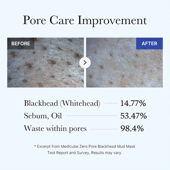 Medicube Zero Pore Blackhead Mud Mask Original 100g - Korean Skincare - Alle huidtypes - Acne - Poriën - Huidverzorging - Glass Skin — cadeau in Verzorging - foto 4