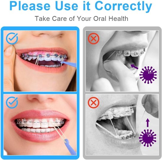 Orthodontische Elastische Rubber Bands, 500 Stuks Dentaal Traction Bands met 5 Stuks Elastische Plaatjes voor Beugels — afbeelding 4