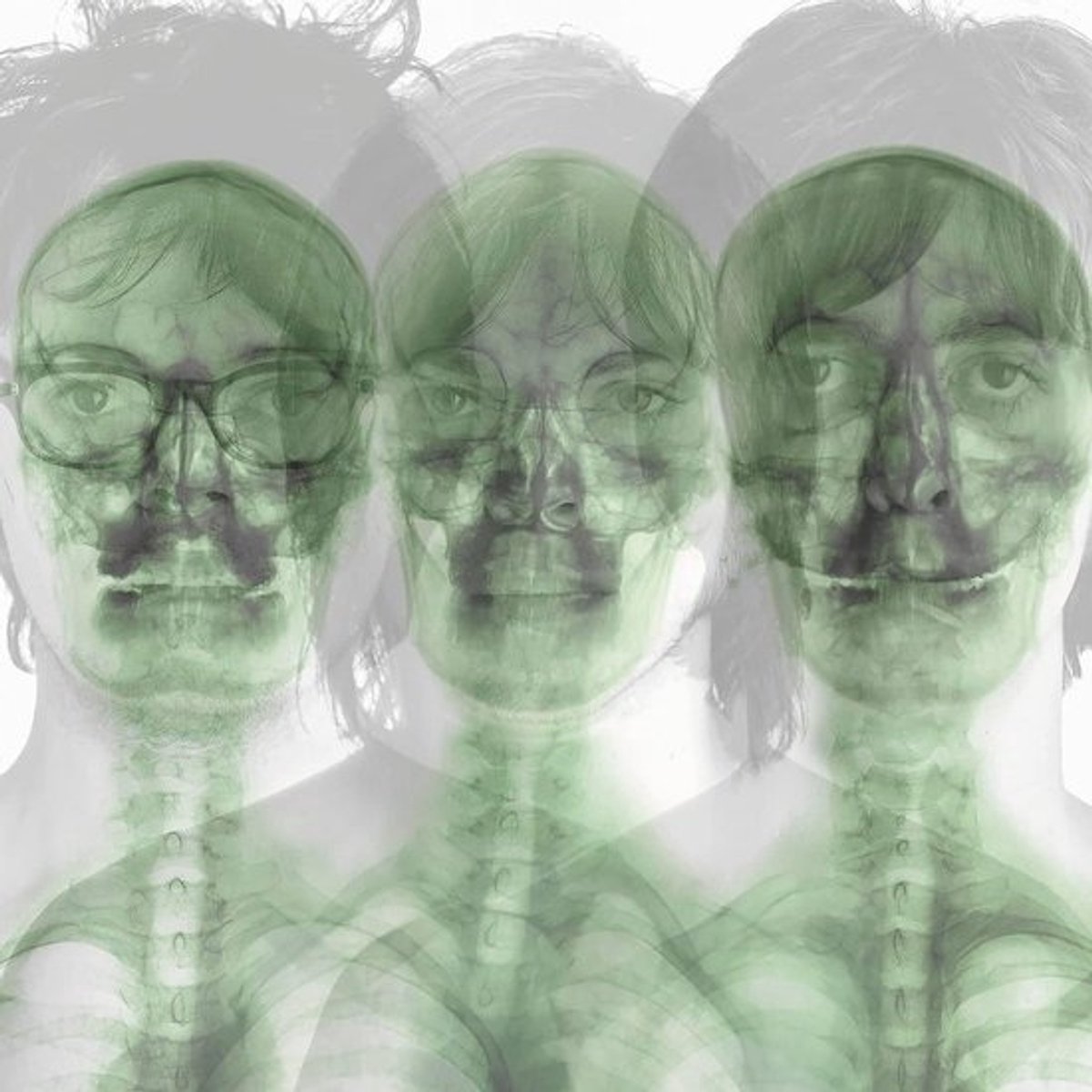 Supergrass - Topkwaliteit Gras voor Tuin en Landschap