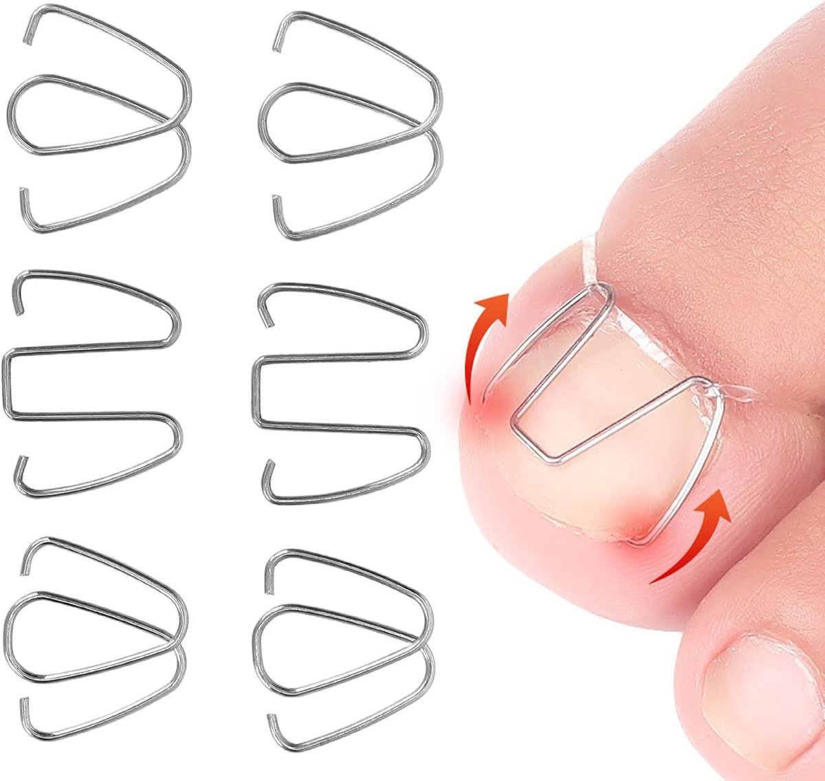 Teennagel Gereedschap, Bunion Corrector voor Pedicure Voetverzorging, Nagel Corrector Ingegroeide Teennagel Draad Lifter Fixer Herstellen