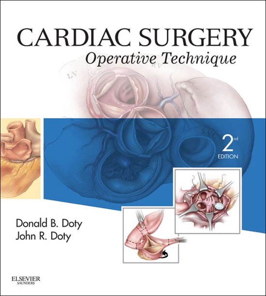 Cardiac Surgery E-Book - cover