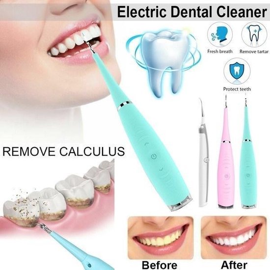 Electric shop tooth cleaner