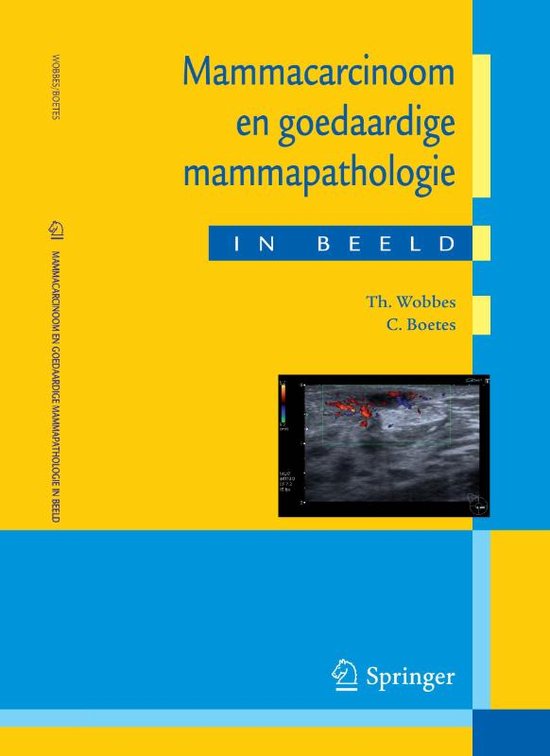 Cover van het boek 'Mammacarcinoom en goedaardige mammapathologie in beeld / druk 1' van T. Wobbes