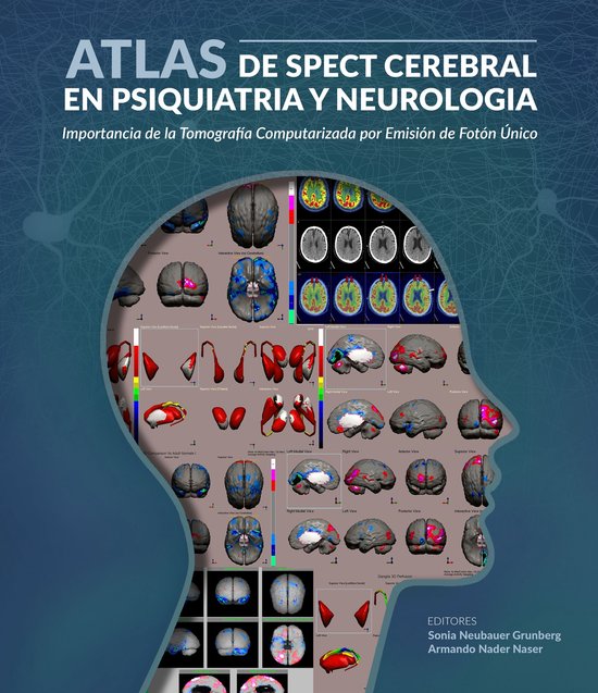 Atlas de spect cerebral en psiquiatria y neurología - cover