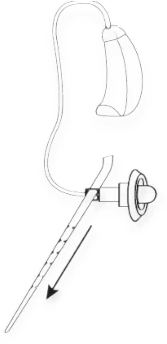 Widex Anchor RIC per 20 stuks