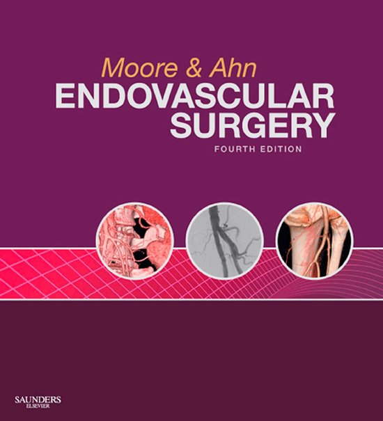 Endovascular Surgery E-Book - cover