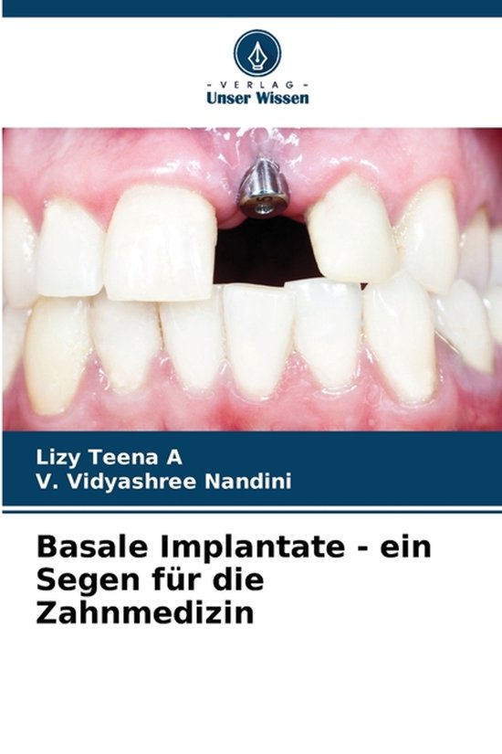 Titelpagina 'Basale Implantaten - een zegen voor de tandheelkunde' met een close-up van een gebit met een implantaat.