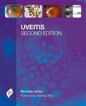 Uveitis