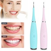 Fitopia Tandsteen Verwijderaar - Elektrisch - Handmatig Tandplak Verwijderen - Ultrasonic Tooth Cleaning - Blauw & Roze