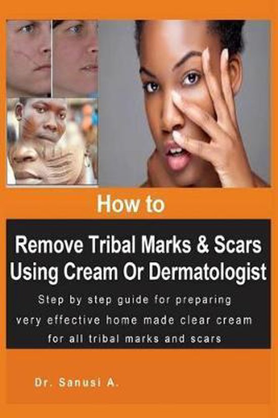How to Remove Tribal Marks & Scars Using Cream Or Dermatologist
