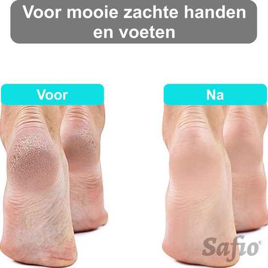 Voor en na foto van de behandeling van droge, gebarsten hielen voor zachte handen en voeten.