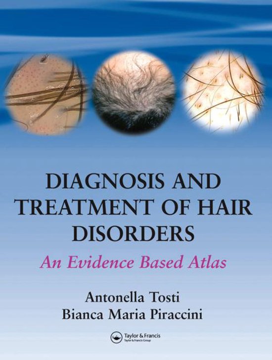 Diagnosis and Treatment of Hair Disorders - cover